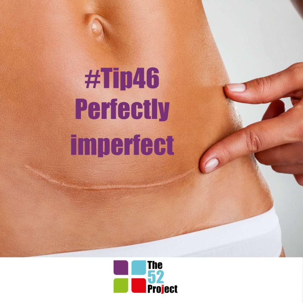 scars, perfectly imperfect, the 52 project, mental scars, physical scars, resilience, wellbeing, dulcie swanston, iain price